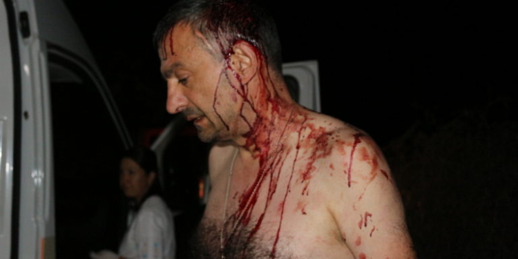 В Одесской области железными битами избили редактора газеты