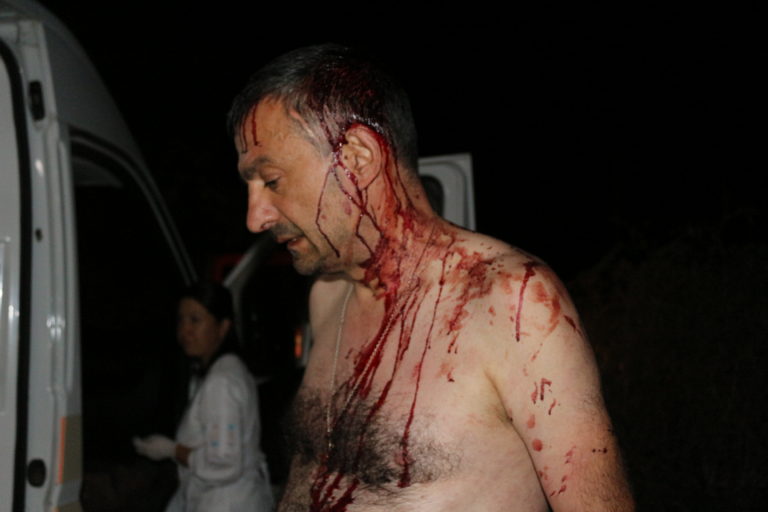 В Одесской области железными битами избили редактора газеты 9