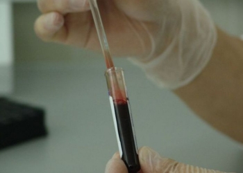 В Киеве зафиксировали первую смерть от лептоспироза