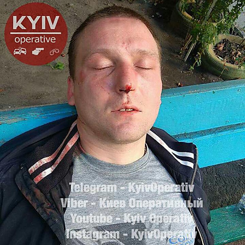 В Киеве на горячем задержали вора – он утверждает, что спасался в чужой квартире от кота 9