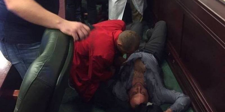 Драка в Киевском облсовете: депутату сломали челюсть и выбили зубы