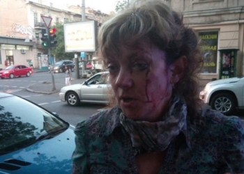 В Одессе неизвестный избил активистку