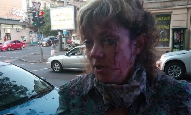 В Одессе неизвестный избил активистку