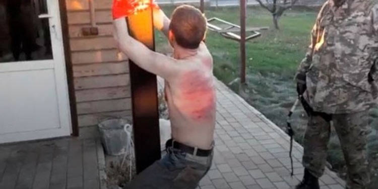 Пытки на Донбассе. Снимали кожу, скальп, кастрировали и распинали на кресте