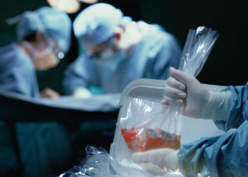 Сколько стоит человек: как набор запчастей – не меньше $1 млн