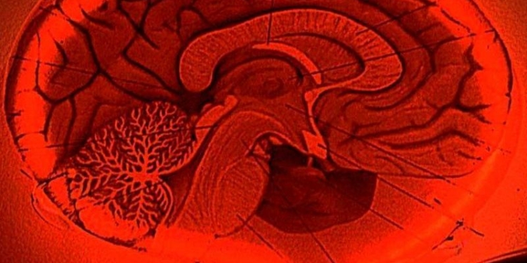 ФМРТ  – медицинская технология обретения сверхспособностей