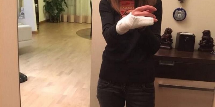 В Киеве патрульные, задерживая нарушительницу ПДД, сломали ей руку – СМИ