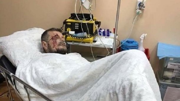 Мосийчук назвал свою версию покушения на него