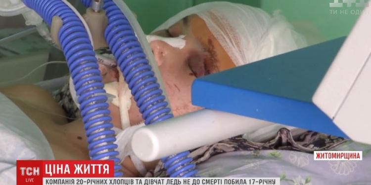 В Житомирской области подростки жестоко избили девушку – ее нашли с проломленной головой