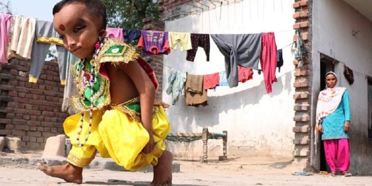 В Индии малыша с необычным черепом считают воплощением бога Ганеши