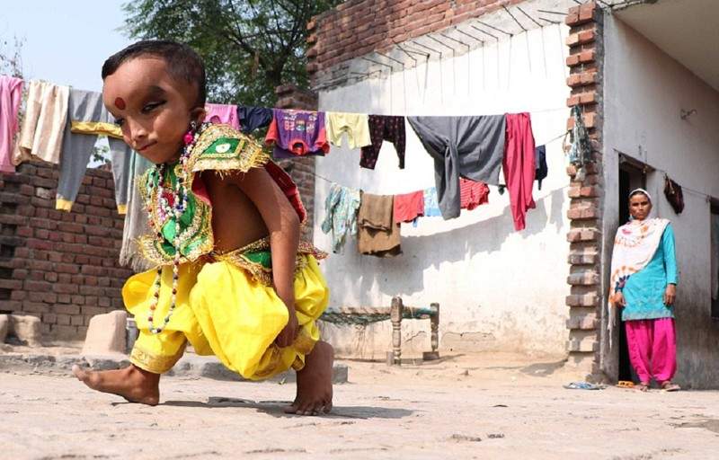 В Индии малыша с необычным черепом считают воплощением бога Ганеши 1