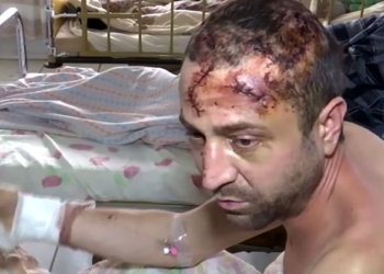 На Житомирщине подполковник полиции пытал брата ради наследства