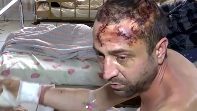 На Житомирщине подполковник полиции пытал брата ради наследства