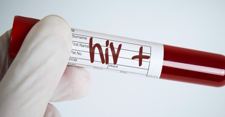 С начала года на Николаевщине впервые выявлено 34 ВИЧ-инфицированных донора