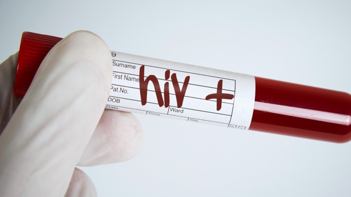 В Николаеве растет показатель распространенности ВИЧ-инфекции 1