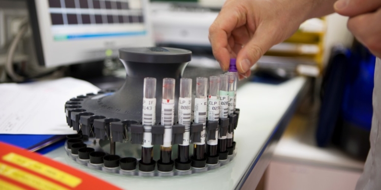 Группа крови влияет на риск сердечного приступа