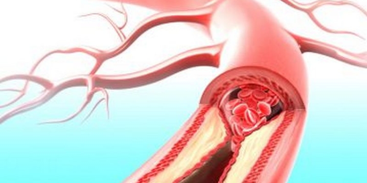 В Ровенской области хотят создать реестр пациентов с заболеваниями системы кровообращения