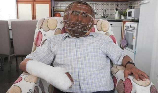 Табачный пояс целомудрия. Житель Турции придумал, как бросить курить