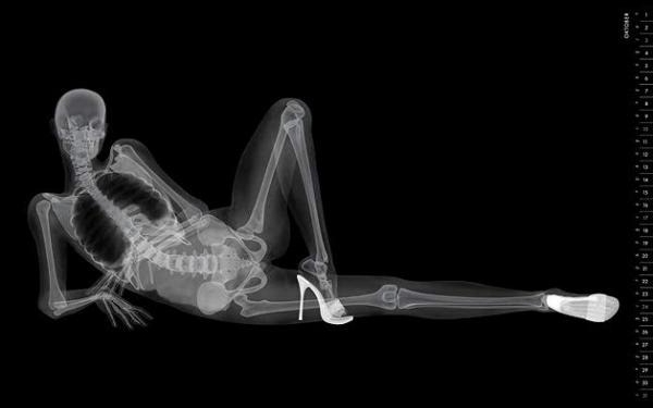 Эротический скелет. Японцы выпустили необычный календарь в стиле рентгеновских снимков