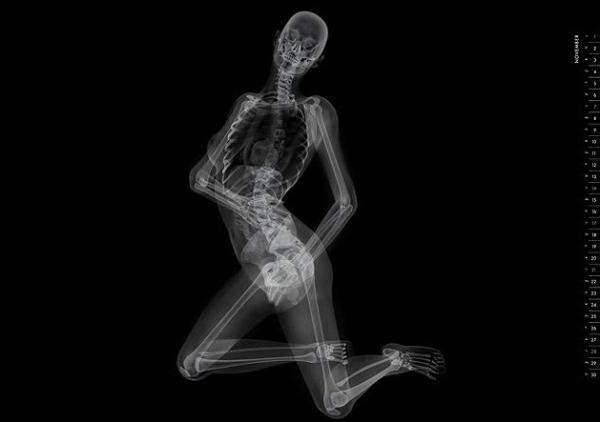 Эротический скелет. Японцы выпустили необычный календарь в стиле рентгеновских снимков 3