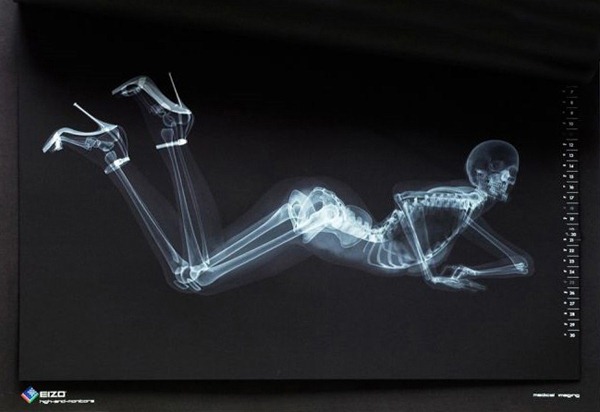 Эротический скелет. Японцы выпустили необычный календарь в стиле рентгеновских снимков 5