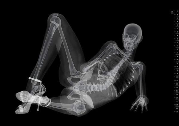 Эротический скелет. Японцы выпустили необычный календарь в стиле рентгеновских снимков 9