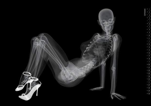 Эротический скелет. Японцы выпустили необычный календарь в стиле рентгеновских снимков 11