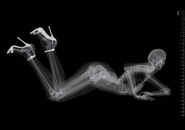 Эротический скелет. Японцы выпустили необычный календарь в стиле рентгеновских снимков 19