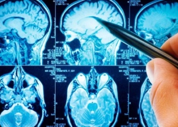 Найти друга можно по МРТ