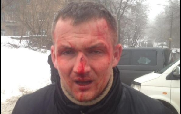 В Киеве избили нардепа. Он в больнице. В полиции сообщили странные подробности