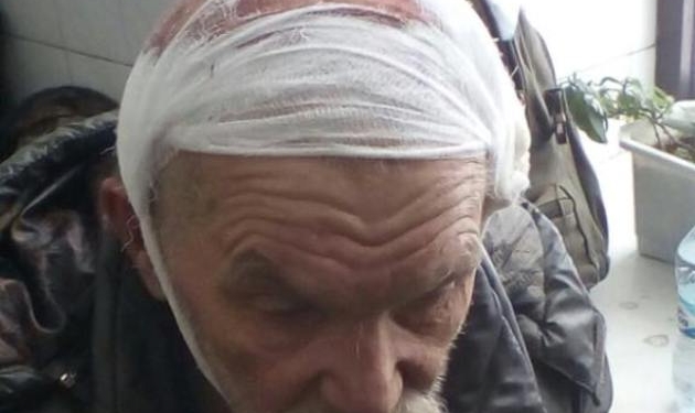 Множественные переломы рук и ног, – в результате разгона палаточного городка у Рады 11 человек попали в больницы