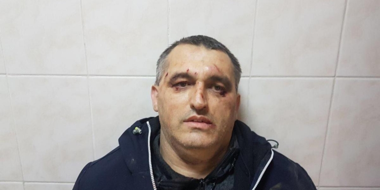 Активиста “Стоп коррупции” в Черновцах избили арматурой. Он расследовал злоупотребления таможни и прокуратуры