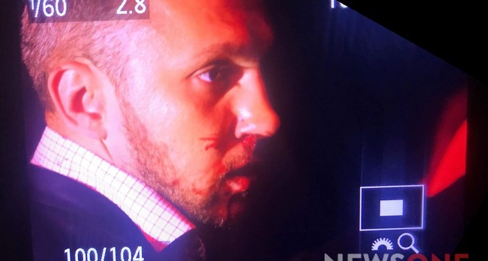 Нардеп Мельничук разбил нос депутату Линько после эфира на NewsOne