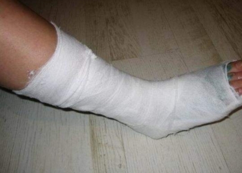 В Индии хирурги тоже всякие бывают:  в больнице мужчине прооперировали ногу вместо головы