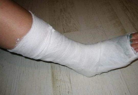 В Индии хирурги тоже всякие бывают:  в больнице мужчине прооперировали ногу вместо головы