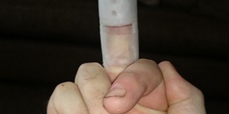 В Николаеве замдиректора зерноторговой компании сломал палец женщине-следователю