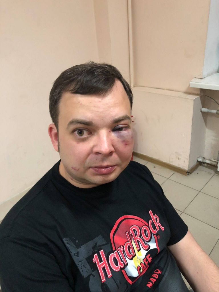 Во время отдыха в ресторане на сына Шуфрича напали неизвестные 15