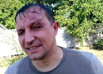 В Кривом Роге напали на депутата горсовета