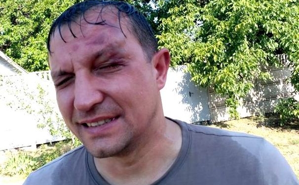 В Кривом Роге напали на депутата горсовета