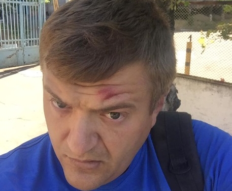 В Херсоне избили журналиста