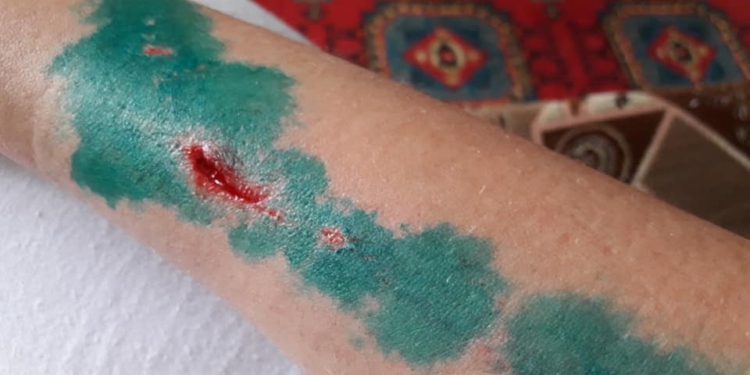 Кто ответит? Отломившийся кусок фасада ранил женщину в самом центре Николаева