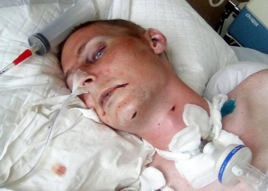 В Николаеве на территории больницы неадекватный мужчина жестоко избил прохожего. Папа 8-летней девочки умер