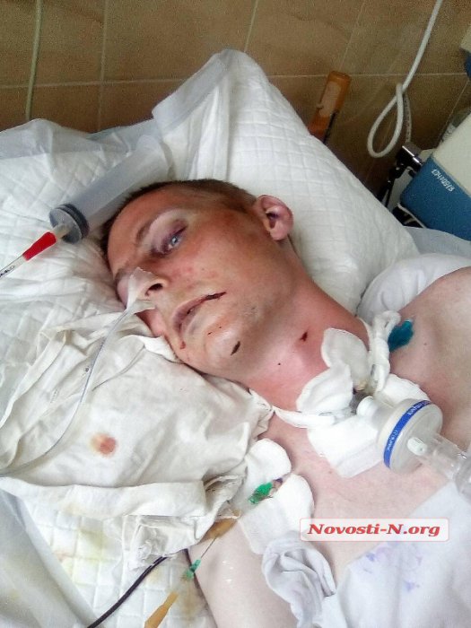 В Николаеве на территории больницы неадекватный мужчина жестоко избил прохожего. Папа 8-летней девочки умер 1