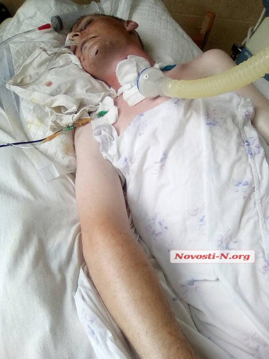 В Николаеве на территории больницы неадекватный мужчина жестоко избил прохожего. Папа 8-летней девочки умер 3