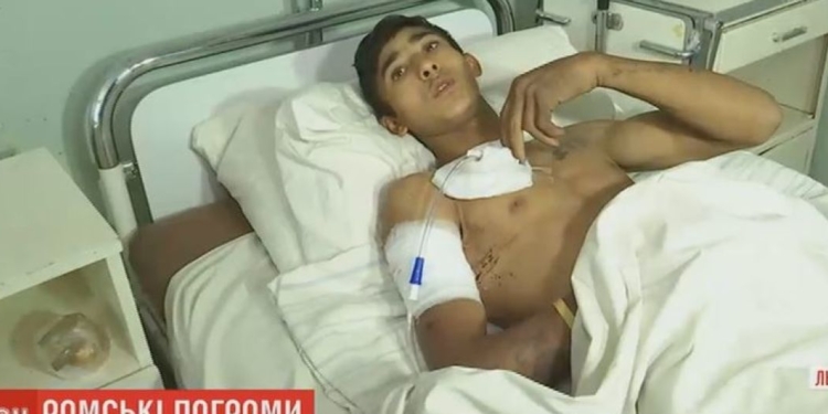 Раненый львовский ром рассказал, как убили его брата