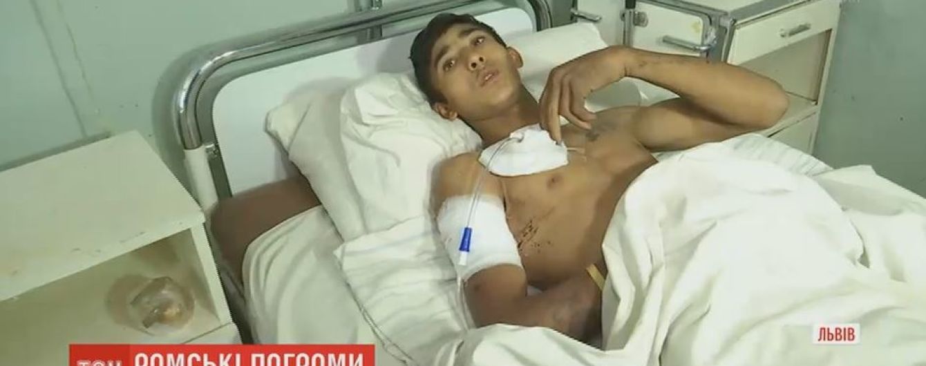 Раненый львовский ром рассказал, как убили его брата