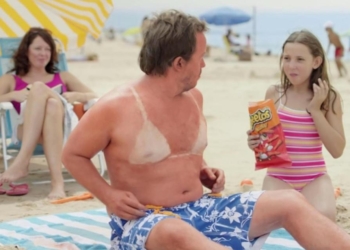 Загорайте осторожнее: курьезные фото подтверждают, что в случае с солнцем жадничать не стоит