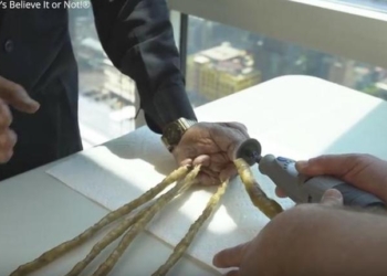 И зачем было растить 66 лет? Индиец наконец-то «расстался» со своими почти двухметровыми ногтями