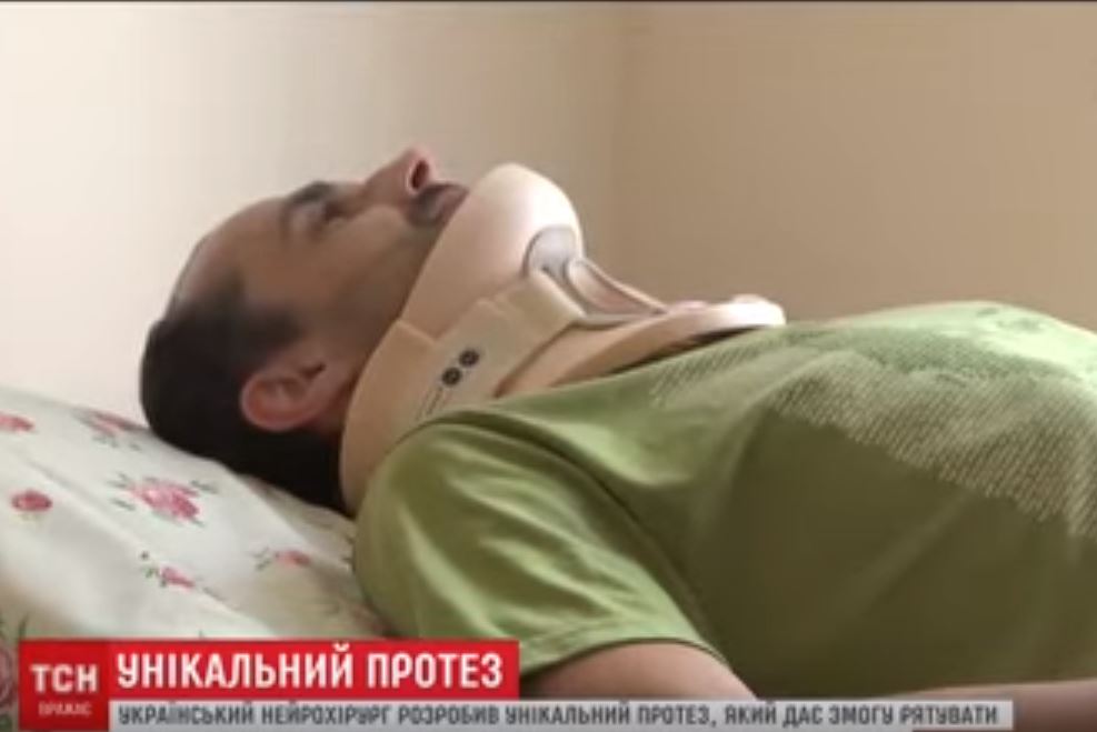 Полноценная жизнь после перелома шеи. Украинский врач изобрел уникальный протез 1