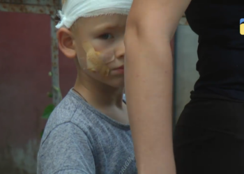 Собаку, напавшую на 4-летнего мальчика в Николаеве, поместили под наблюдение. Ребенок чувствует себя хорошо